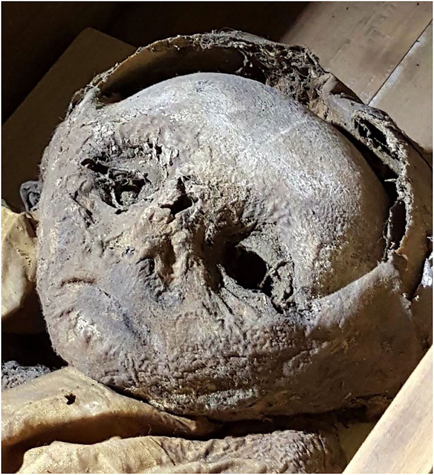 Una autopsia virtual identifica a un niño momificado del siglo XVII aristócrata pero desnutrido fmed 09 979670 g003