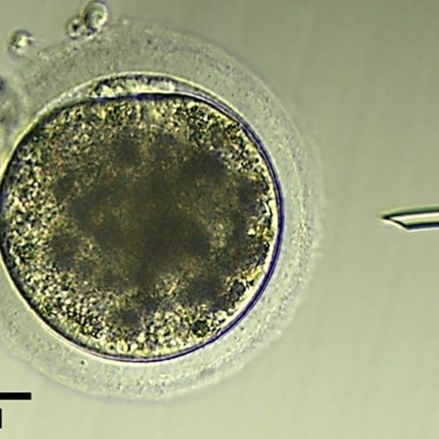 EuropaPress 4817223 ovulo burra inmediatamente antes inyeccion intracitoplasmatica