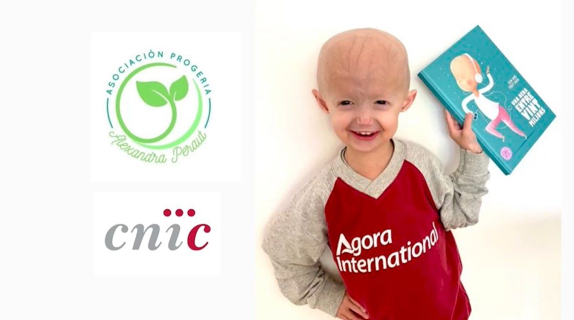 Progeria: así es el síndrome raro que acelera el envejecimiento en la niñez