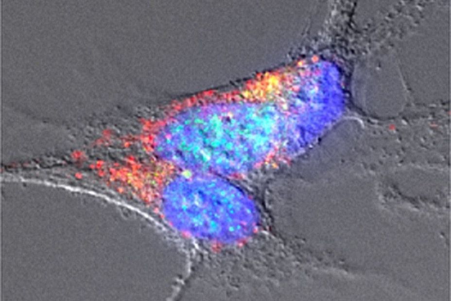 Nuevo descubrimiento en la enfermedad de Párkinson: los amiloides bacterianos (Europa Press)