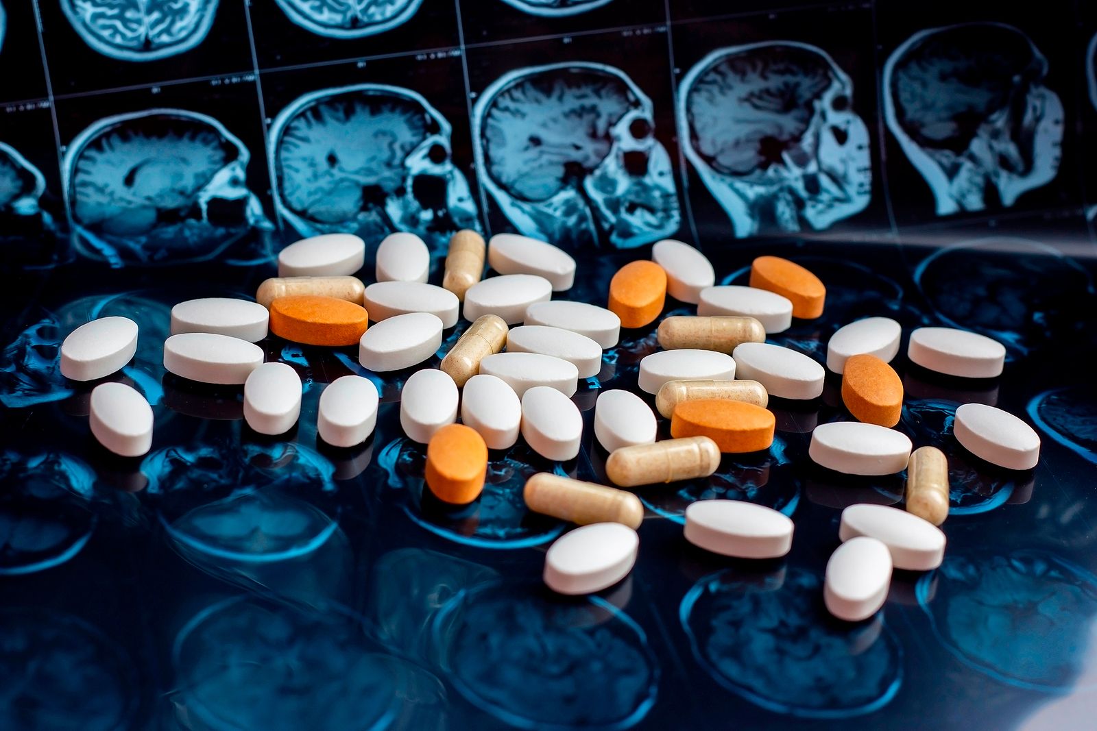 Europa rechaza autorizar Lecanemab, el medicamento que se comercializa en EEUU contra el alzhéimer