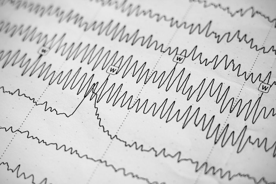 El ritmo al que envejece el cerebro depende también del país donde vivas