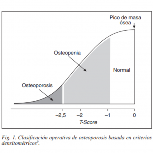 Gráfico explicativo de la osteopenia y la osteoporosis basado en la densidad ósea. Fuente: Sociedad Española de Endocrinología y Nutrición (SEEN)