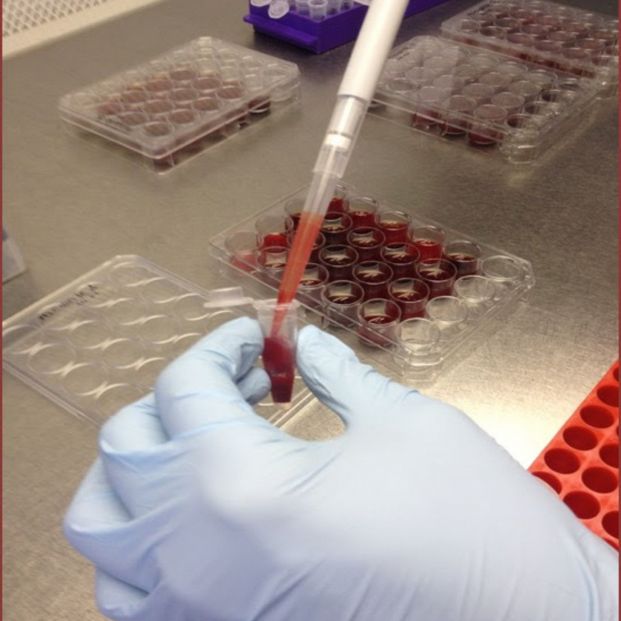 Blood sample at the Zaidin experimental station. Source: DISCOVER FUND