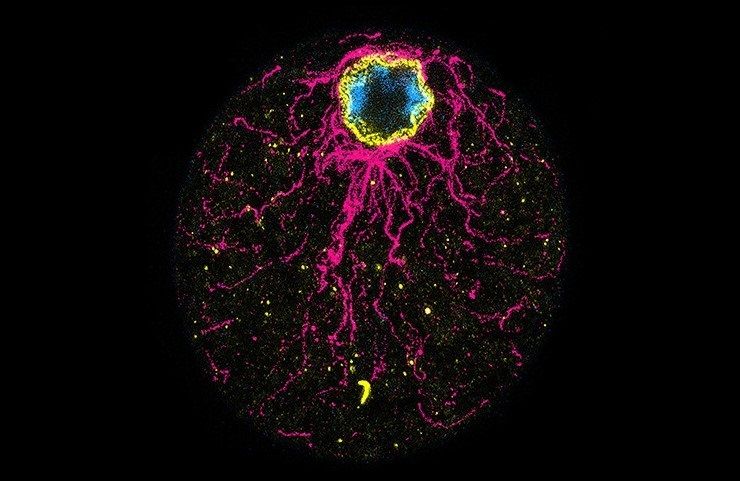 Célula de la ictiospora C. Perkinsii que muestra signos distintivos de polaridad, con una clara localización cortical del núcleo antes de la primera división. Los microtúbulos se muestran en magenta, el ADN en azul y la envoltura nuclear en amarillo.