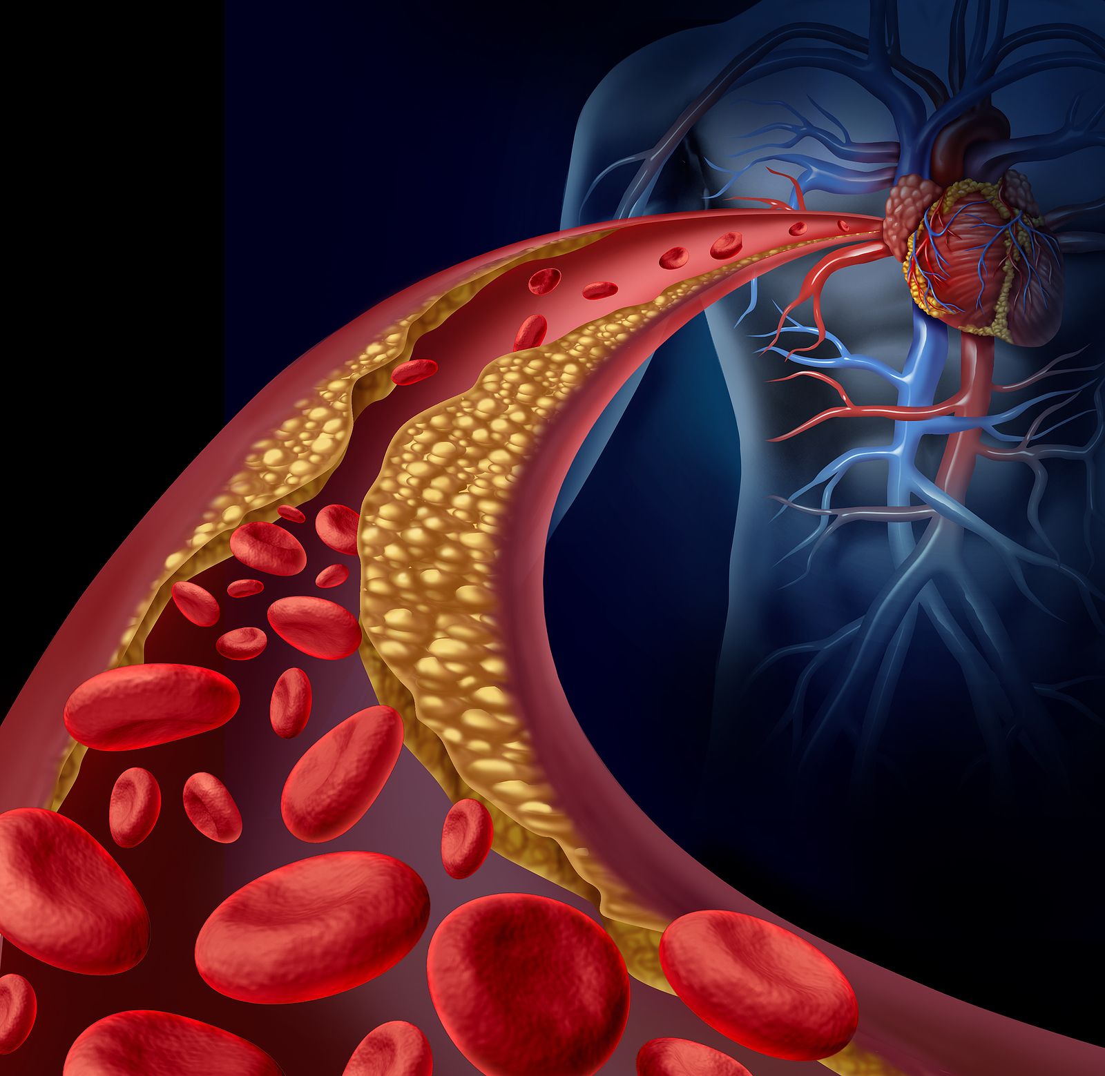 Un estudio vincula el riesgo cardiovascular con la gingivitis y el síndrome de ovario poliquístico