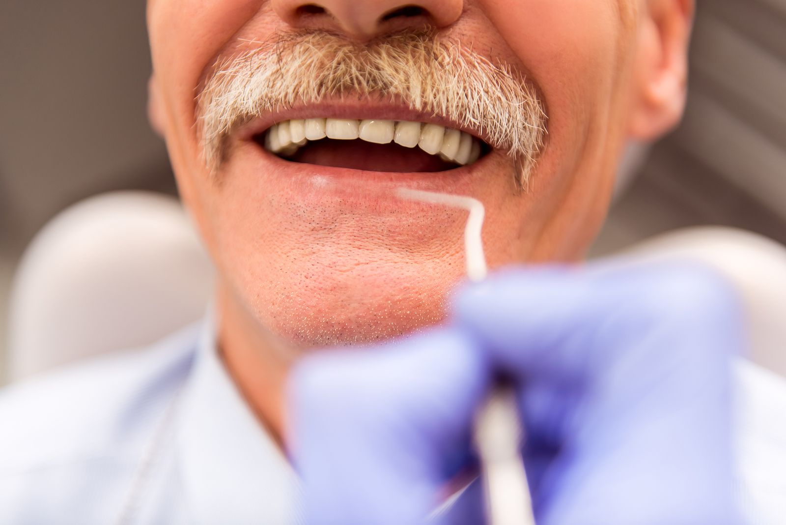 Estos son los peligros de realizarse tratamientos caseros de blanqueamiento dental