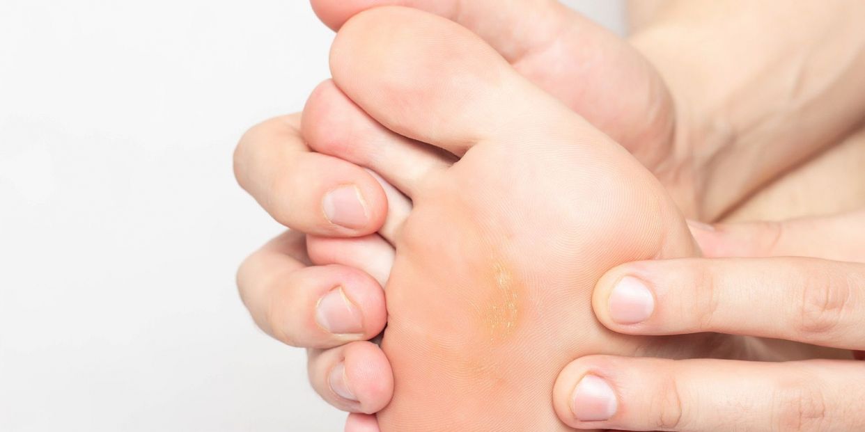 El truco definitivo para quitar las durezas o los callos de los pies